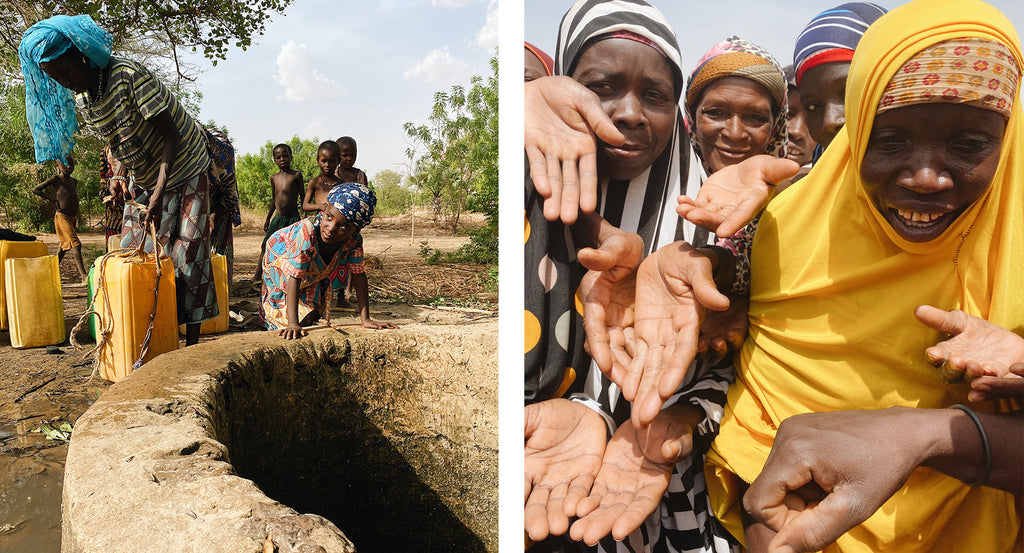 An open, contaminated well in Niger & women who have calloused hands | neverthirst in Niger