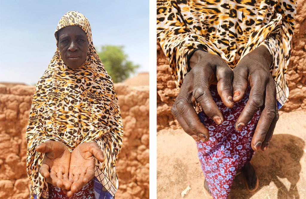 A woman in Niger shows her hands | neverthirst in Niger
