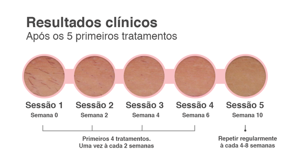 resultados clínicos após os cinco primeiros tratamentos