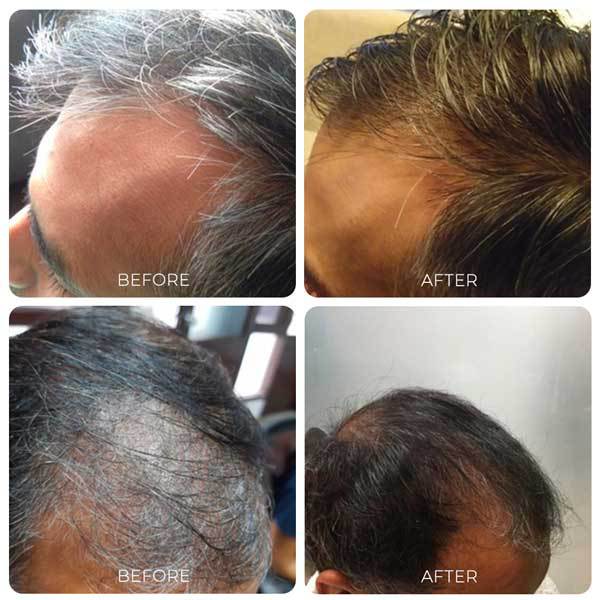 Kalika Hair Oil For White Hair, Results Before and After