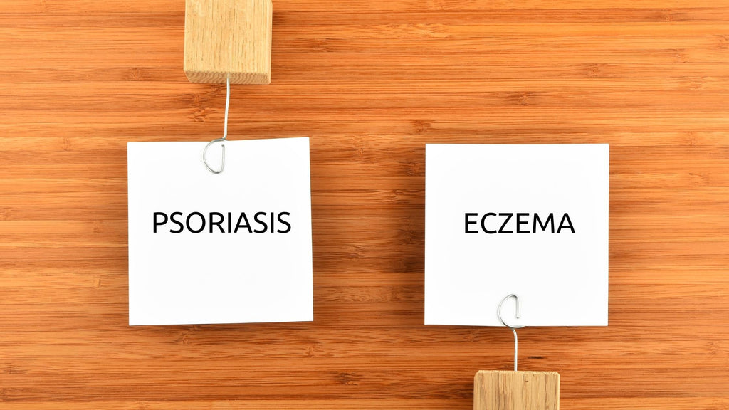 psoriasis and eczema difference