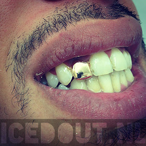 Varken Snoep uitlokken Grillz kopen? | Groot Assortiment – ICED OUT