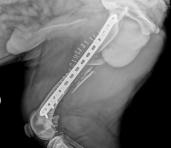 Post op patient 5 IMPeek plate rod fracture repair