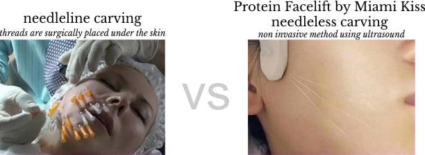 Protein Facelift by Miami Kiss - needle carving vs needleless carving