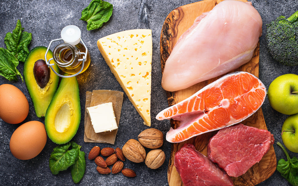 Variety of healthy foods on a table