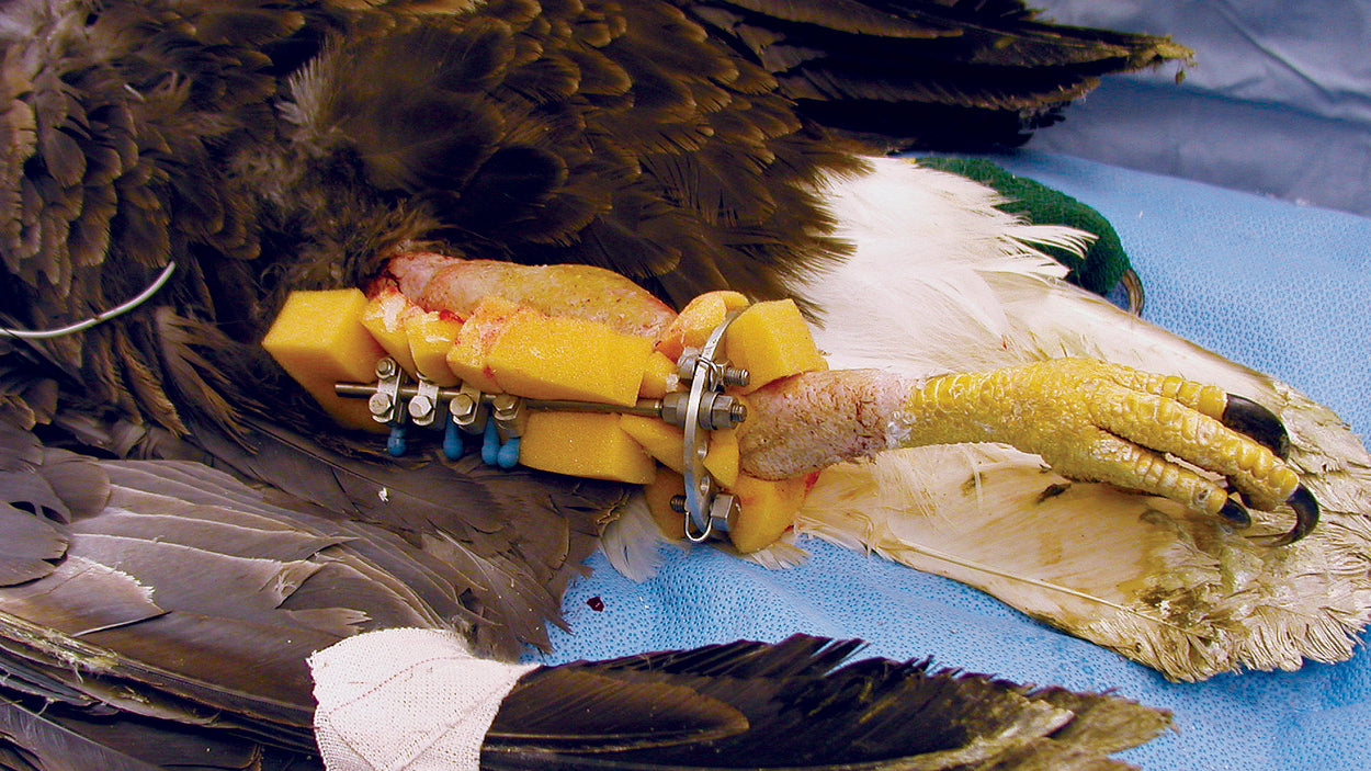 Bald Eagle with a Type 1b hybrid ESF frame with postoperative sponges
