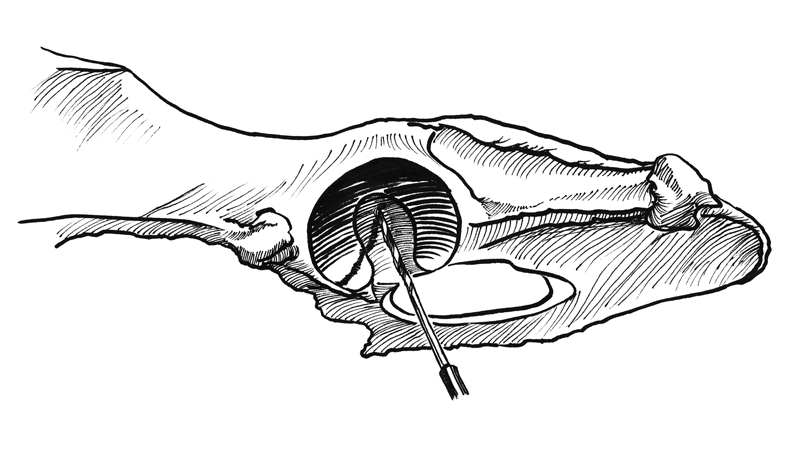Craniolateral Approach to the Hip (Illustration)