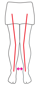 Check knee alignment illustration: Knees angled in