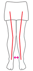 Check knee alignment illustration: Knees angled in