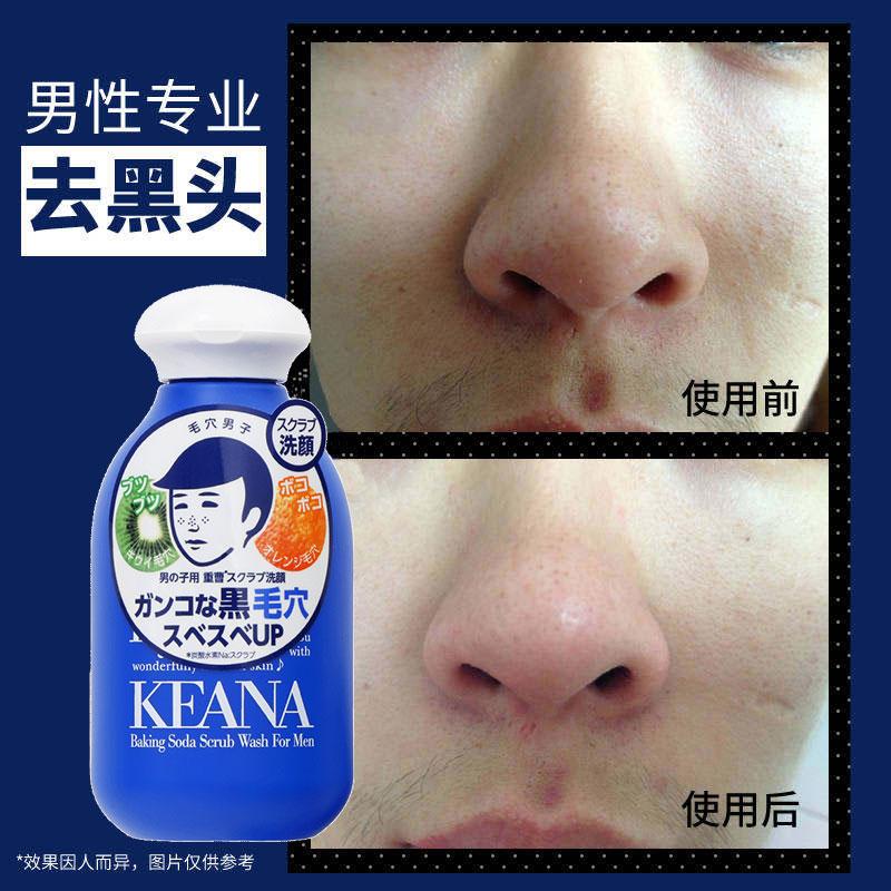 毛穴抚子男士专用小苏打磨砂洁颜粉 买吧the Best Shop