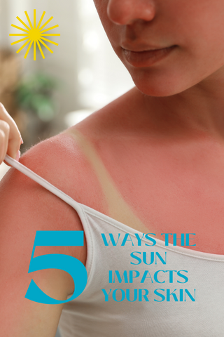 Woman with sunburn pulling shoulder strap down