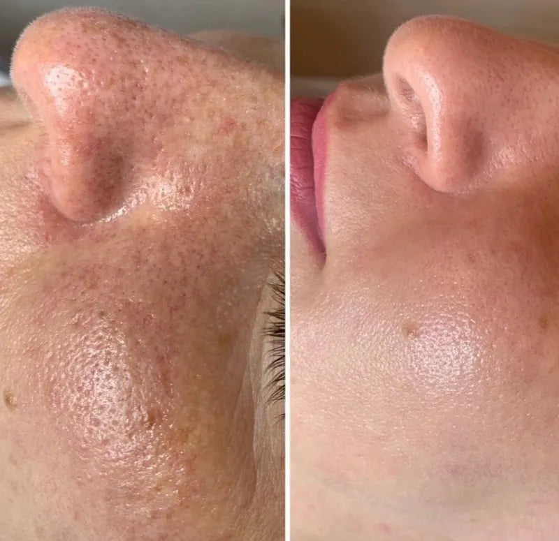 rs=w-800,cg-true,m.webp__PID:51c7c695-5118-4acd-9aa4-12cc31a150ef