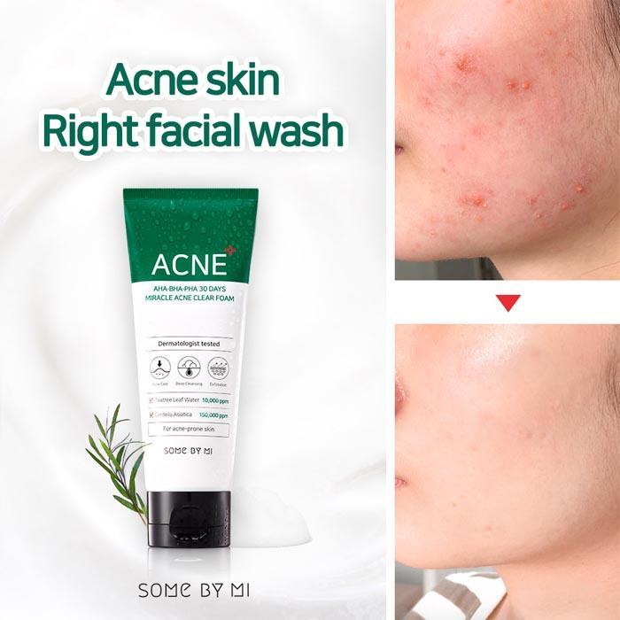 clear day acne clinic