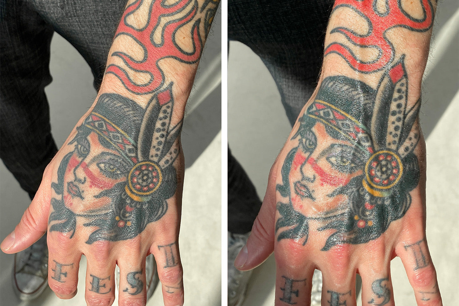 Irresponsible Tattoo Aftercare Leads To Bad Tattoos