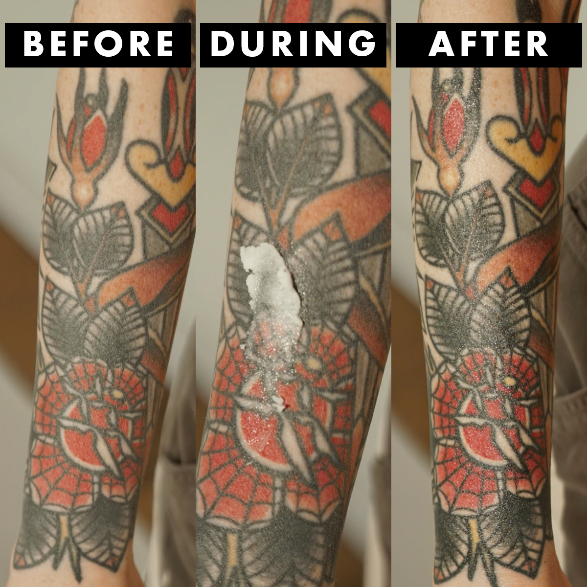 Tattoo Infection Symptoms and Treatment