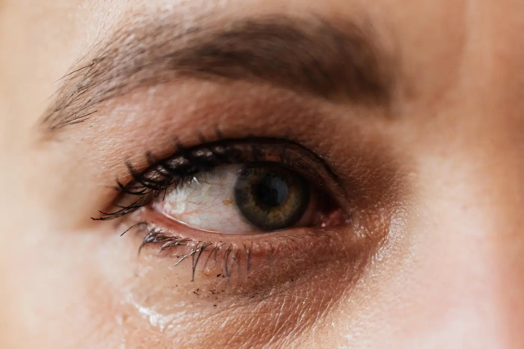 A woman's eye that is irritated from a grass allergy