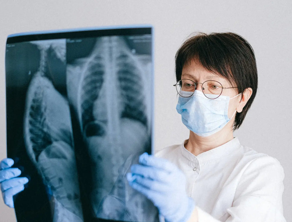 doctor with a mask holding an x-ray of the lungs