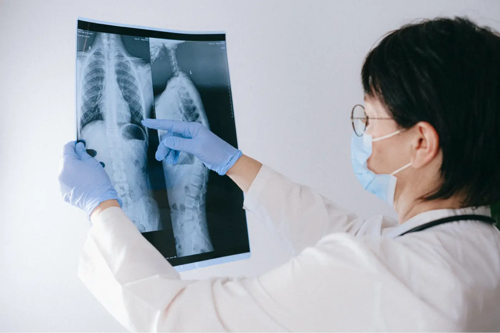 doctor showing chest x-ray with lung infection