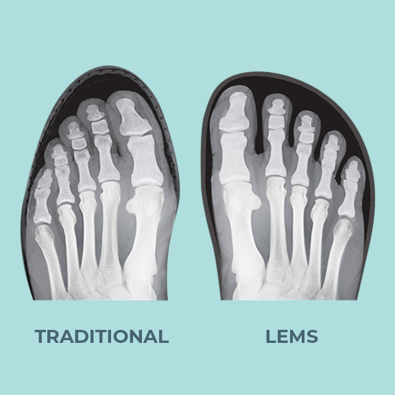 xray_82ec1885-3bc8-43b6-9922-633f1be896b9_700x.jpg