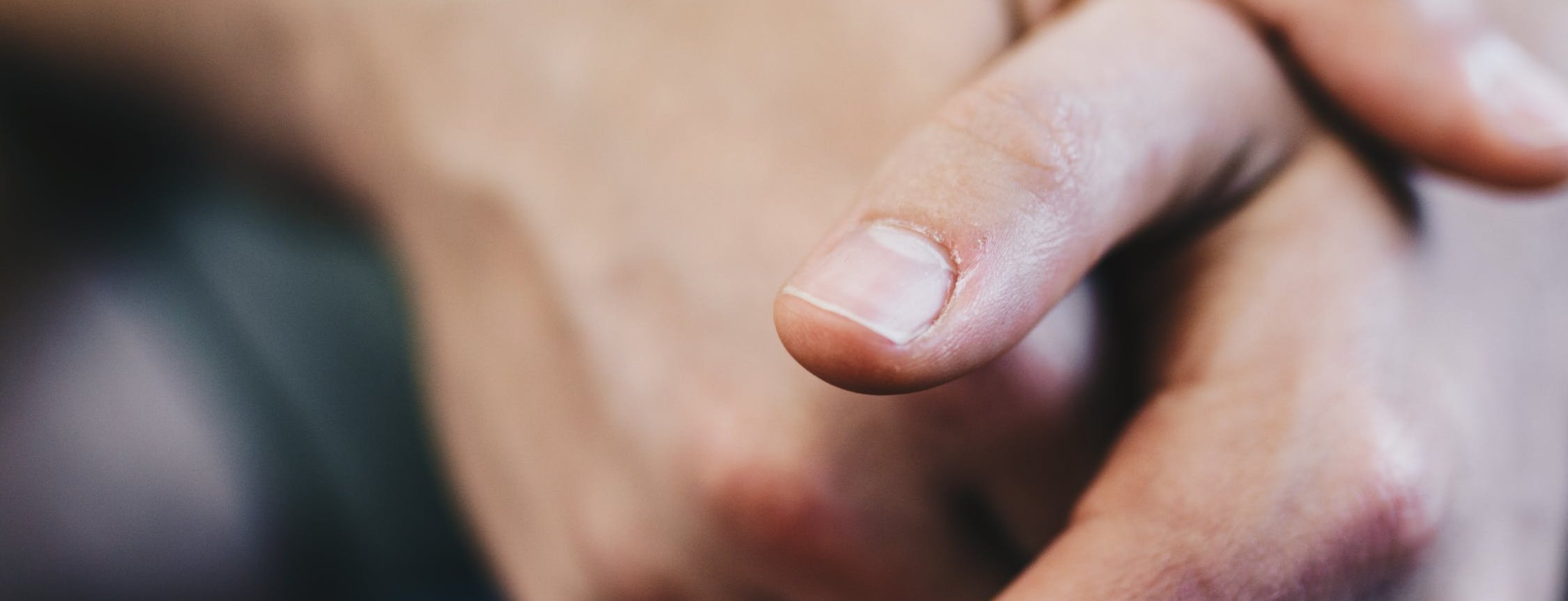 Por qué salen manchas blancas en las uñas