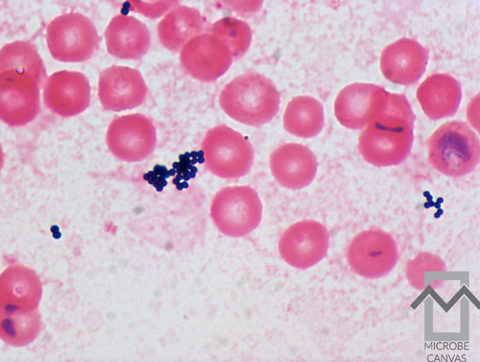 Staphylococcus epidermidis - microbewiki