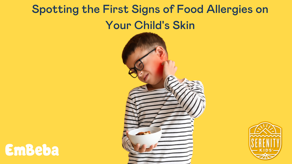 Child scratching from rashes and ezcema due to food allergies
