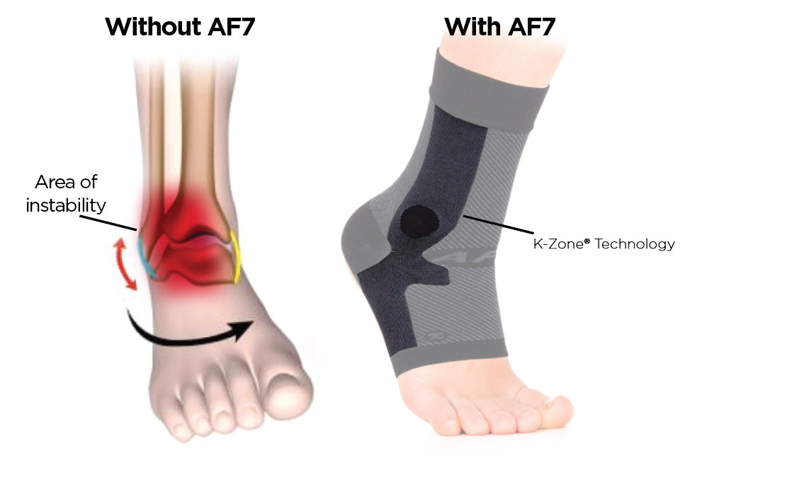 before and after the AF7