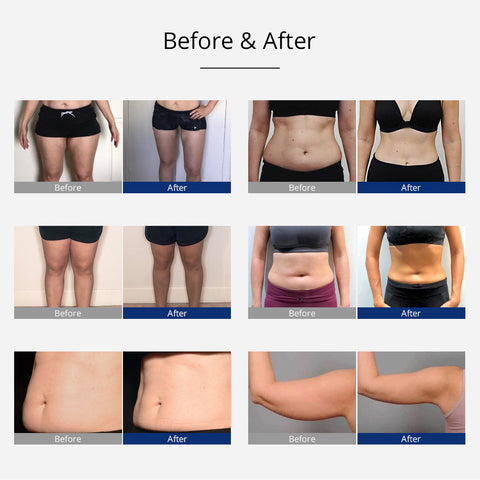 slimming before and after