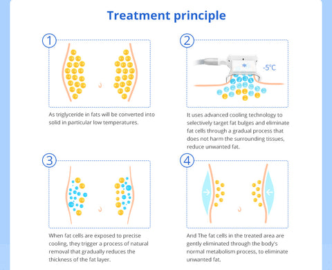 Cryolipolysis fat freezing