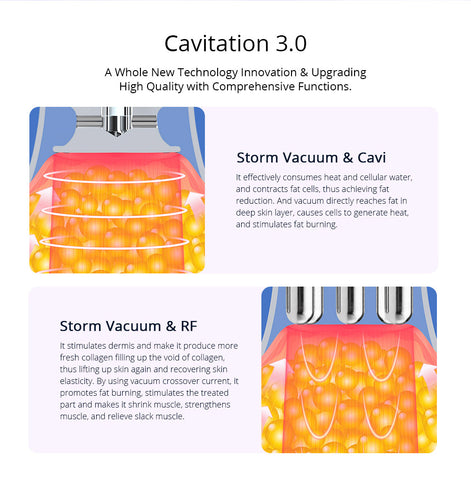 cavitation 3.0 vacuum rf