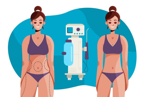 the differences between laser lipo and cavitation