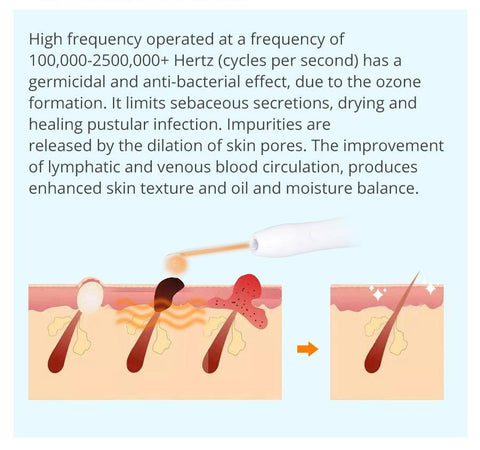 high frequency cleaning