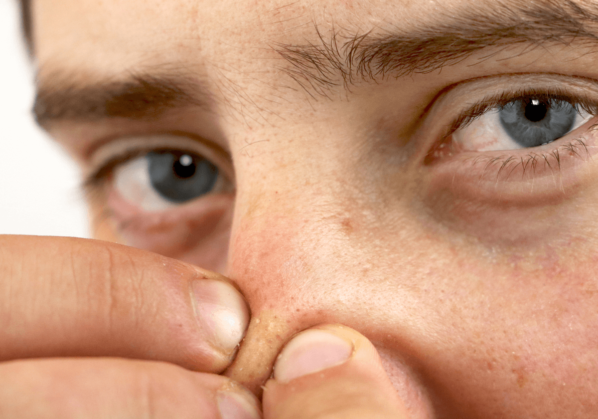 a woman is squeezing her blackheads on nose