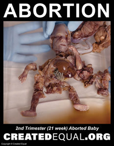 Abortion Victim Sign