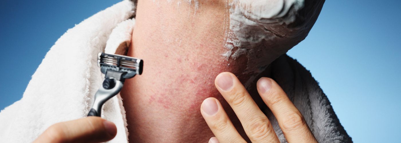 Does Aftershave Prevent Razor Bumps