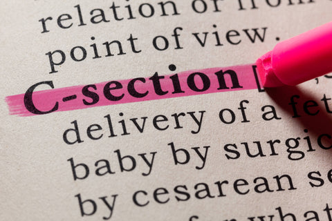 what is c-section delivery