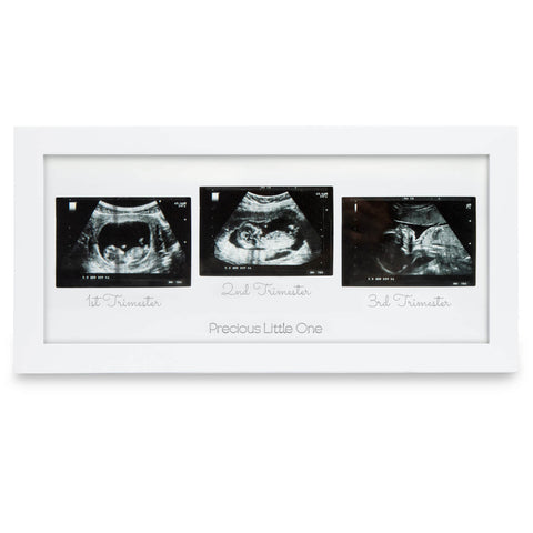 Pregnancy/Maternity Ultrasound And Photo Album/Keepsake : : Baby