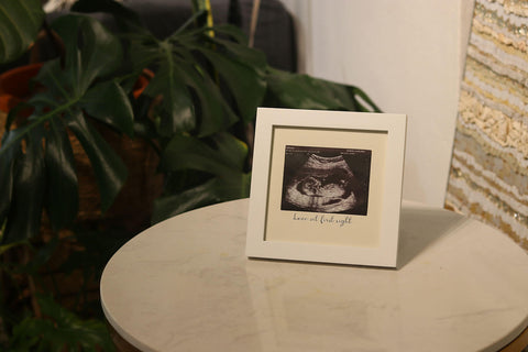 sonogram frame