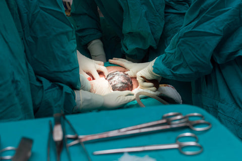 Caesarean section delivery