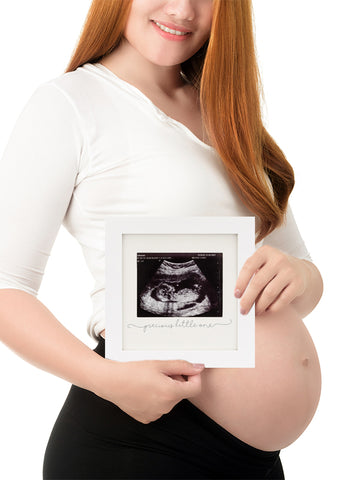 Baby sonogram picture frame