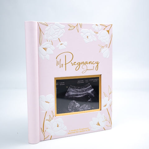 Beautiful and Exquisite Piece Featuring a high-quality hardcover front page filled with detailed blossom illustrations, our pregnancy journal is a piece of art for you to keep. The pages are ring-bound for easy journaling and reading. The elastic book band adds more privacy while on the go.  KeaBabies Tip:  Bring your pregnancy journal to every doctor's visit to record doctor's advice.