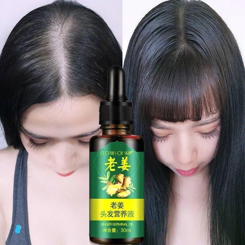 Hair Growth Serum Best Oil For Hair Growth And Thickness Bodwellbeing 7081
