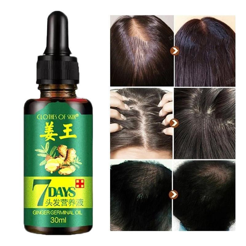 Hair Growth Serum Best Oil For Hair Growth And Thickness Bodwellbeing 8869