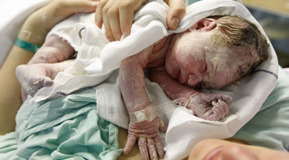 baby born with white stuff
