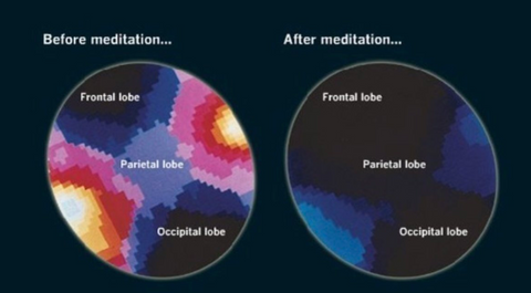 Brain image after medation