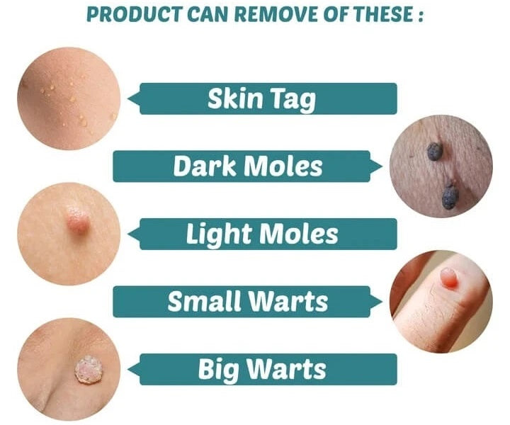 Skin tag removal treatment patch uses dermatologist tested salicylic formulation to remove skin tags safely. The patch works by shrinking and drying the skin tags until they fall off naturally.