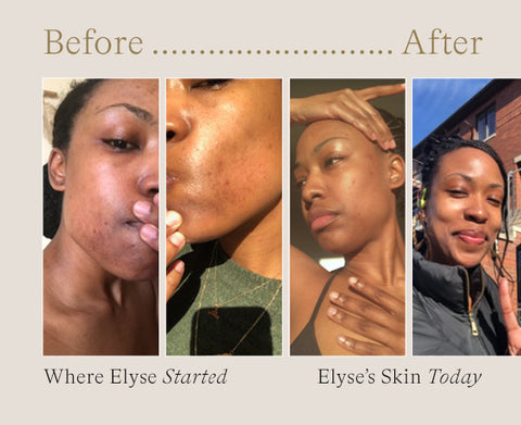 Before & After with Muri Muse Elyse Hamme 