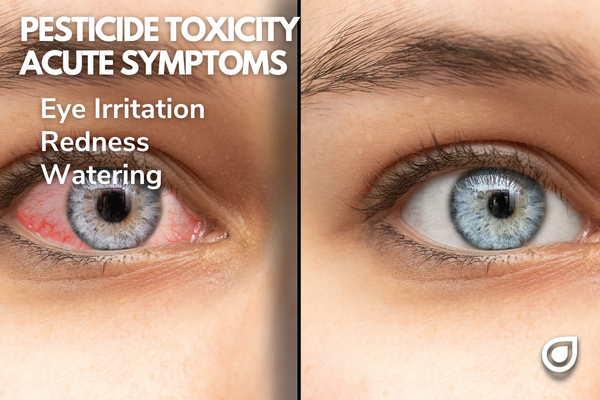 Pesticide Toxicity Acute Symptoms Eye Irritation Redness Watering