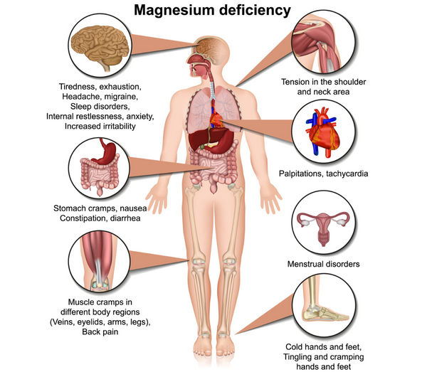 Magnesium Deficiency Visual