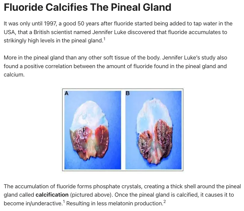 Fluoride Calcifies The Pineal Gland